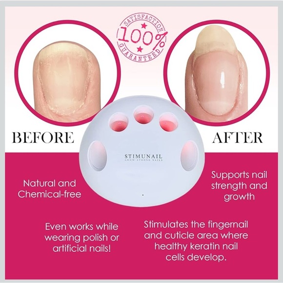 StimuNail Nail Wellness Device - Supports Grow Long Strong Nails -Used - Picture 3 of 6